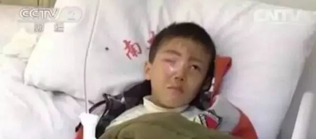 6岁孩子眼球10分钟被融化,7岁孩童几秒眼睛被溶化