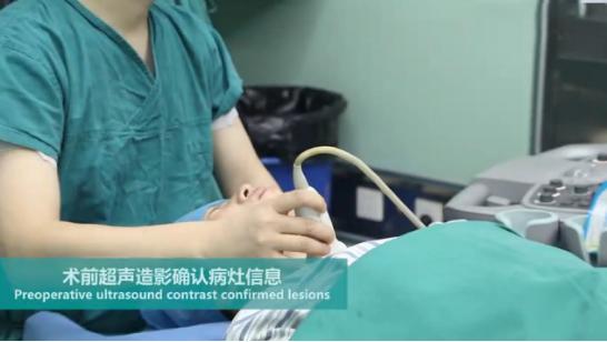 微波消融术，让甲状腺患者康复“加速度”