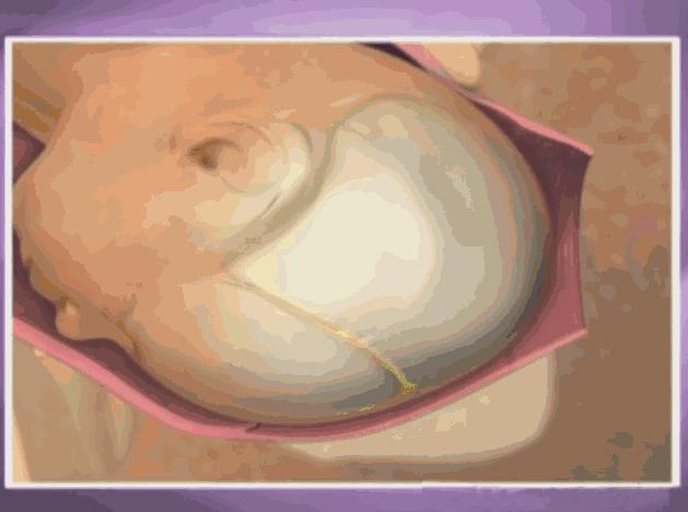 顺产10天肚子隐隐作痛怎么回事,你知道顺产要怎么用力吗