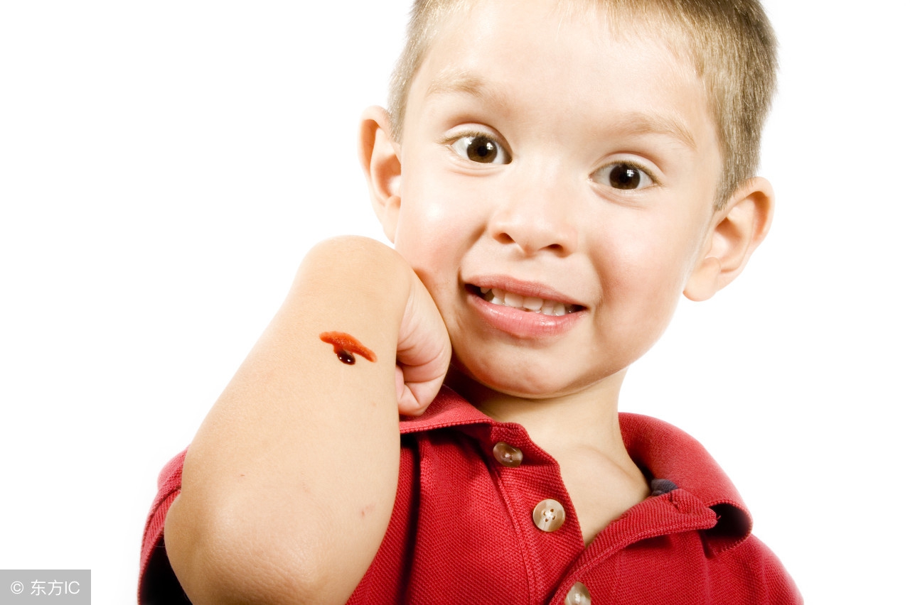 小孩碰伤出血能用碘伏消毒吗,小孩外伤擦碘伏会不会疼