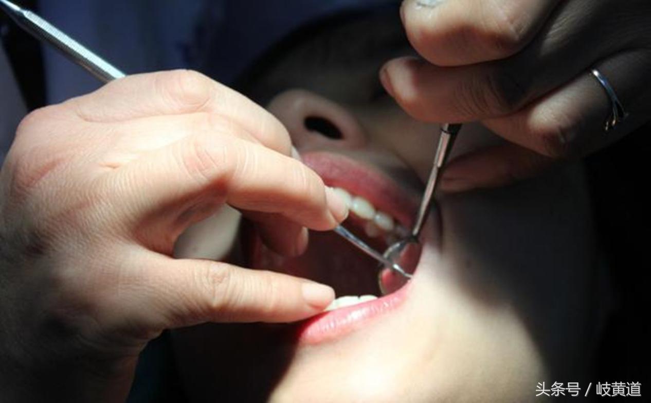 补牙为什么要弄死牙神经,补牙为什么要杀死牙神经