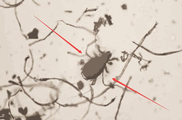 家中螨虫怎么消灭,家里全是螨虫教你一招除螨