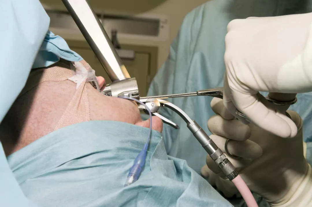 从腹痛到癌症仅三个月,从肚子痛到去世仅三天