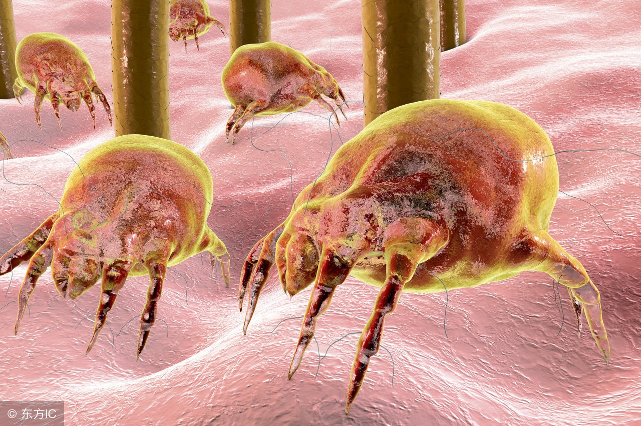 脸部螨虫怎么消灭才能彻底除根,脸上螨虫反复发作