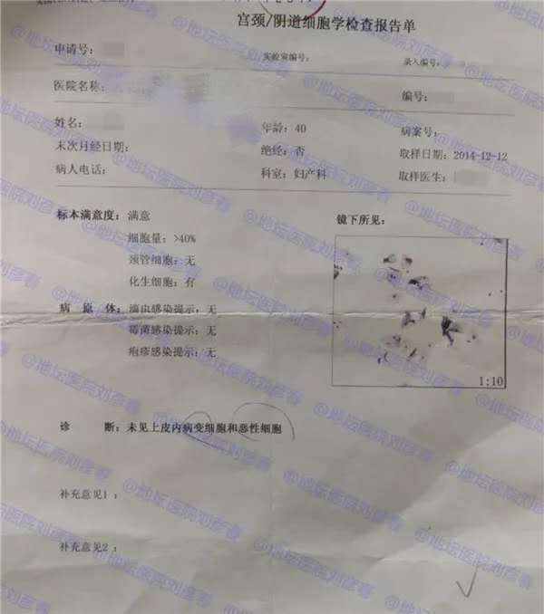 病例分享最新,hpv病例分享