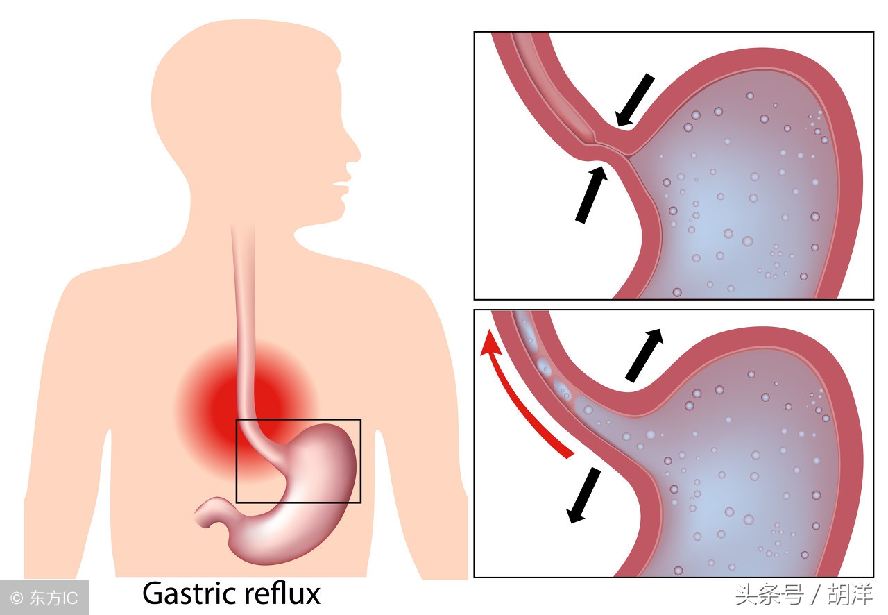 用什么机器能查出食管癌早期,医生一招搞定食管癌