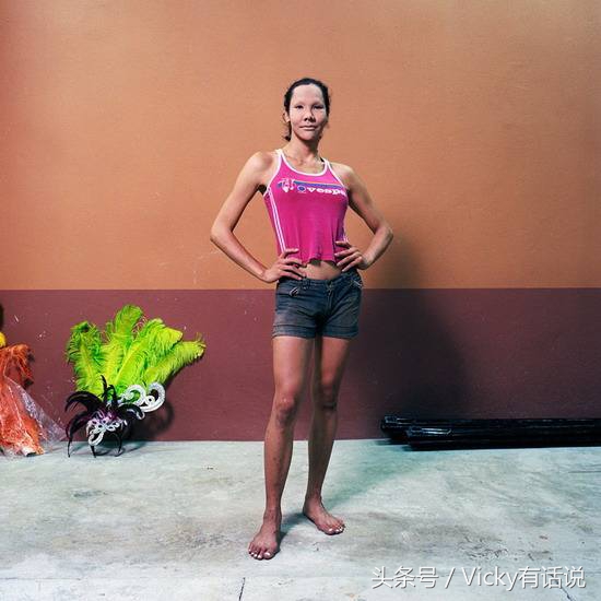 泰国人妖无死角变性手术,泰国人妖变性手术后寿命长吗