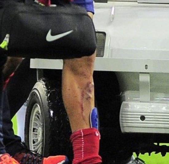 巴西足球球场惨案,巴西杀人犯