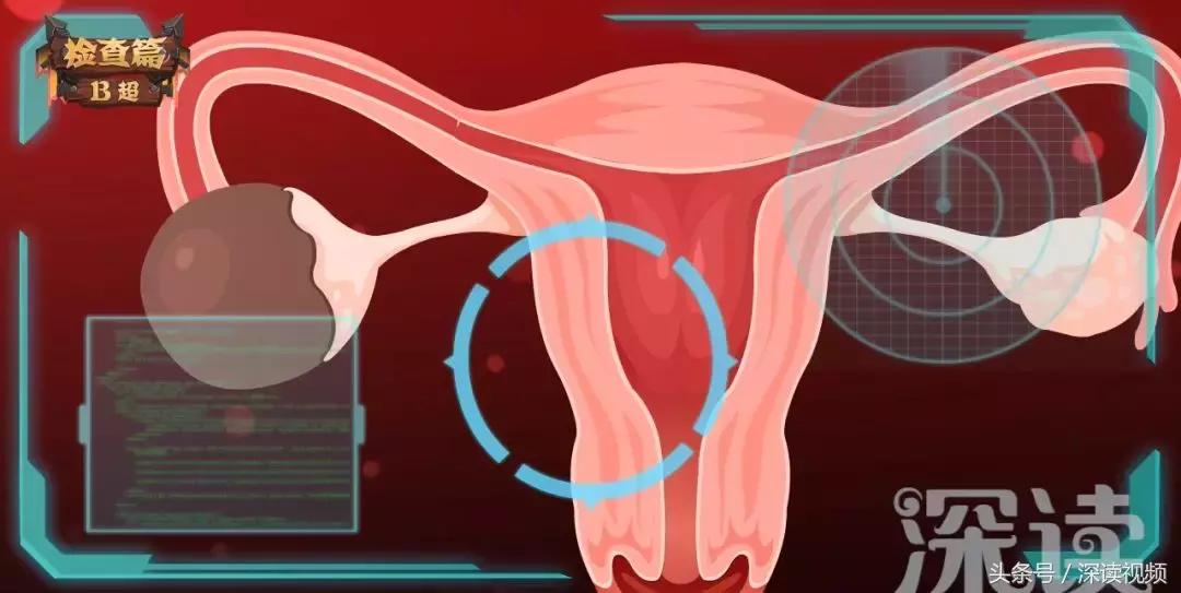 姨妈痛不用药,姨妈痛也不需要吃药