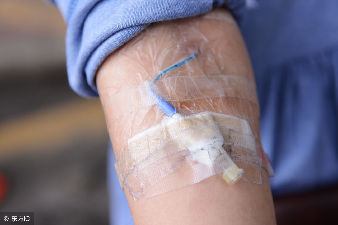 如何判断非霍奇金淋巴瘤治愈,怎么判断胃淋巴瘤严重程度