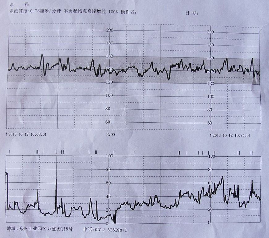 胎心监护图如何看胎儿有没有动,胎心监护图下面的线表示啥