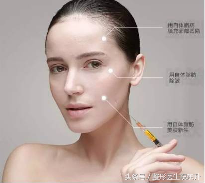 自体脂肪术后注意事项,自体脂肪脸部填充不忌口会怎样