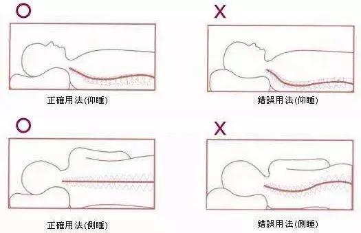 经常落枕按哪个穴位,中医落枕正骨视频教学