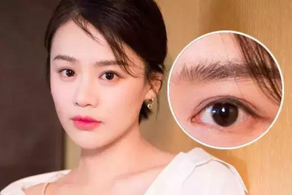 再来一波抗衰科普,你是不是对面部抗衰有什么误解