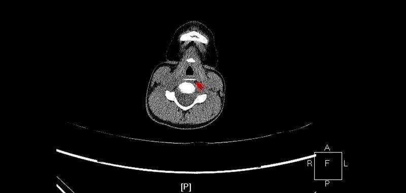 一些让人毛骨悚然拍到的照片,六个令人毛骨悚然的影像