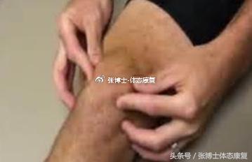 膝关节滑膜皱襞综合征锻炼,膝关节滑膜皱襞综合征怎么治