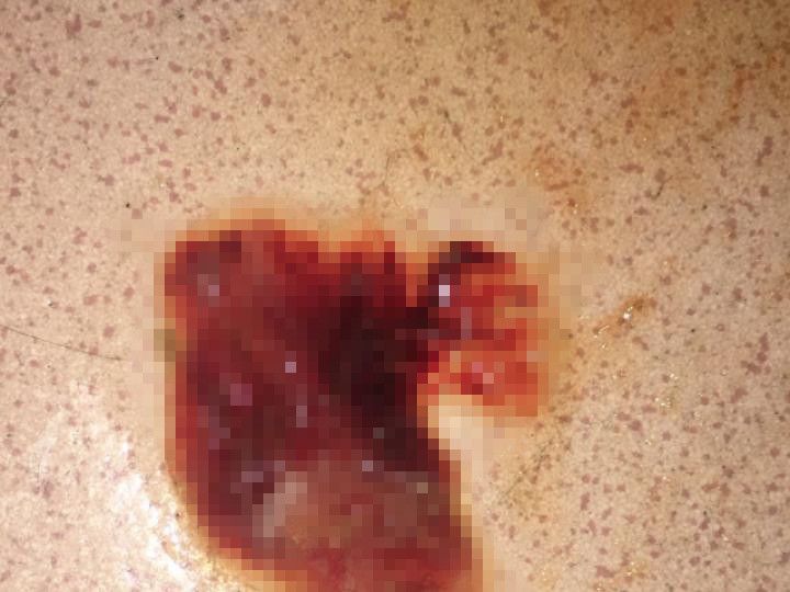 狗狗呕吐是什么原因引起的病,狗狗呕吐的五大原因和三步疗法