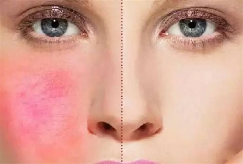 皮肤紧致怎么用英语表达,用英文表达皮肤状态