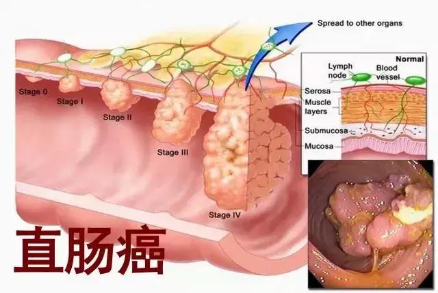 “上海第一美女”自杀，这一点却被忽略了