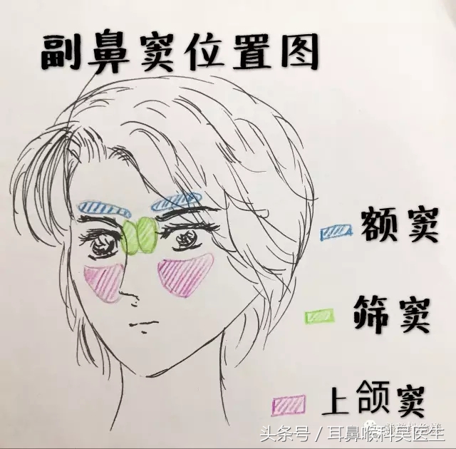 鼻炎鼻窦炎鼻息肉有什么区别,鼻炎和鼻窦炎究竟有什么区别