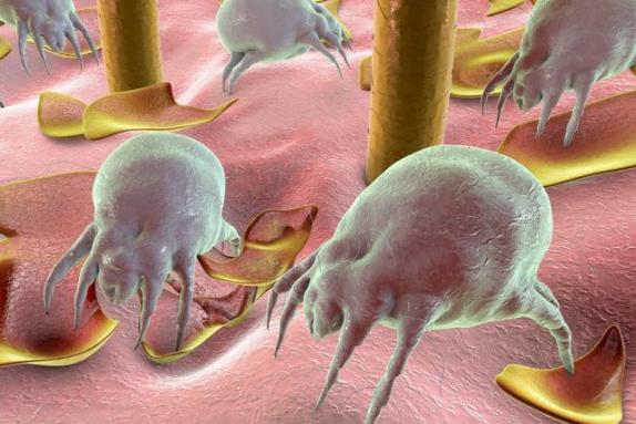 后背一直出痘，原来是大量螨虫的原因，用这三个小方法快速搞定！