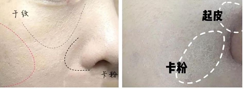粉底液卡粉浮粉斑驳怎么办,unny粉底液干皮怎么涂不卡粉浮粉