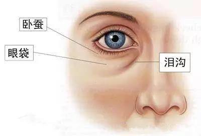 眼袋是身体哪里的问题,眼袋是哪里出问题