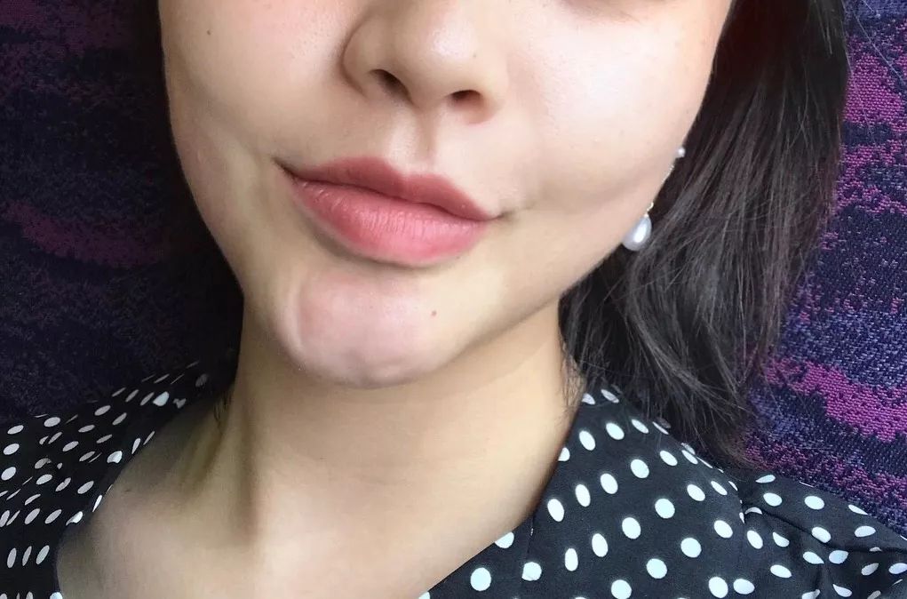 美白丸推荐好物,澳洲美白丸真的可以变白吗