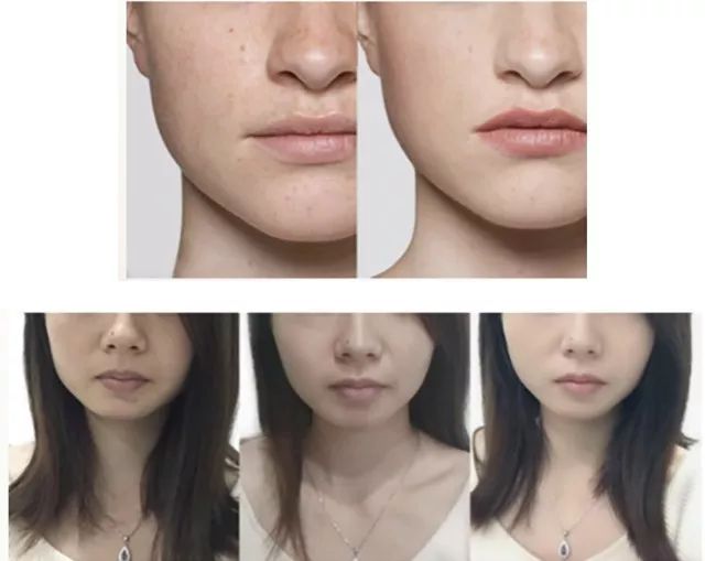 澳洲美白丸效果好吗,澳洲美白丸有用吗