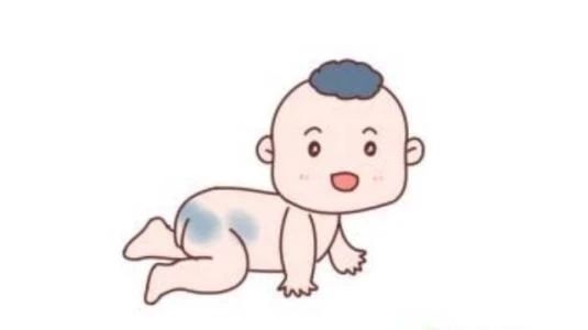 宝宝屁股上有青印,宝宝屁股上有划痕是什么情况