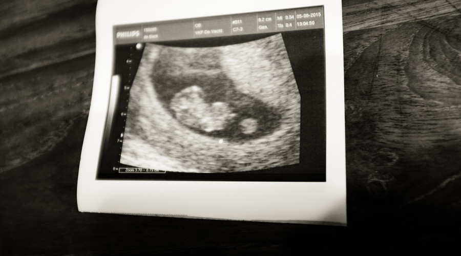 怀孕7个月离婚怎么处理,七个月的孕妈如何离婚