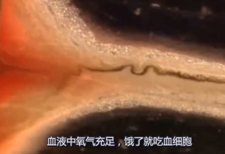 吃活物有寄生虫,吃活的虫子身体里有寄生虫