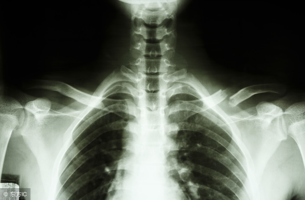 小孩骨折保守治疗不用药水的吗,为什么儿童骨折医生建议保守治疗