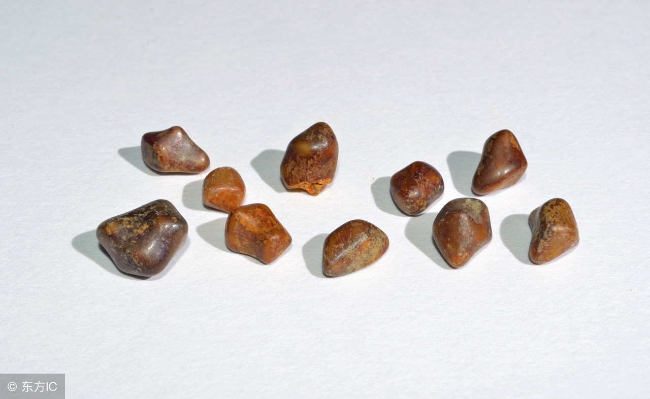 彩超检查没有发现肾结石,通过什么方法能检查出肾结石