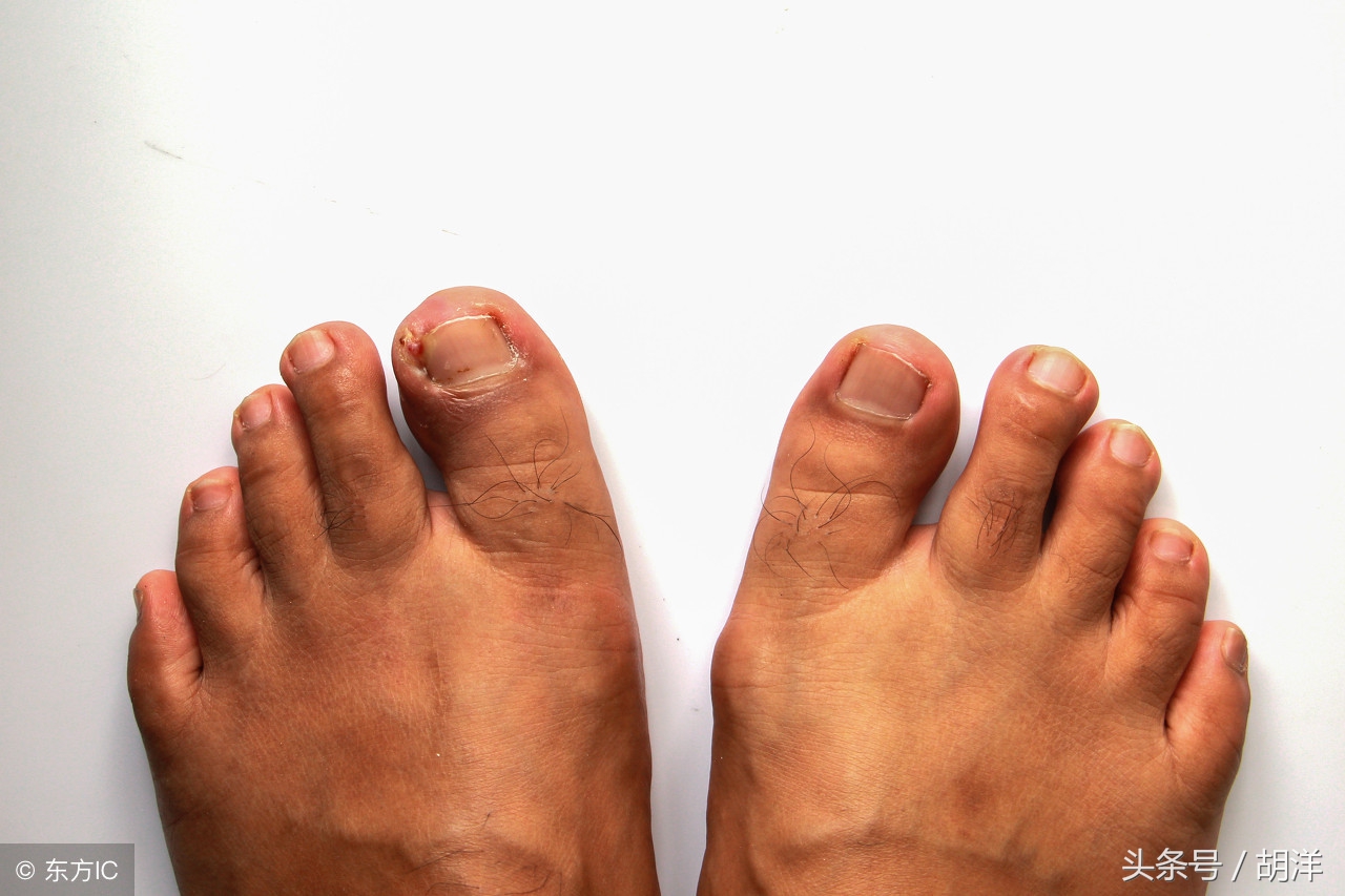 癌症吃靶向药有哪些副作用,吃癌症靶向药有什么副作用吗