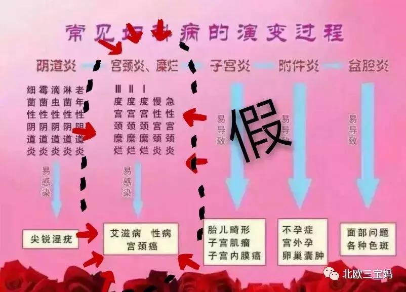 宫颈糜烂能发展到宫颈癌吗,从宫颈糜烂到hpv的过程