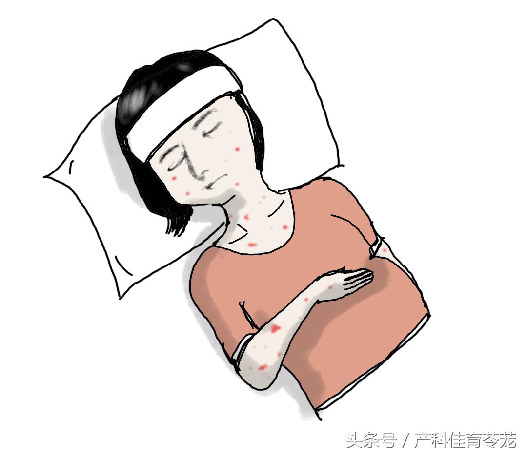 孕期发热用药指南,怀孕初期发热38双腿出疹子