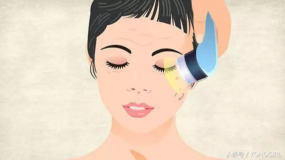 点痣的十大忠告,自己点痣的十大忠告