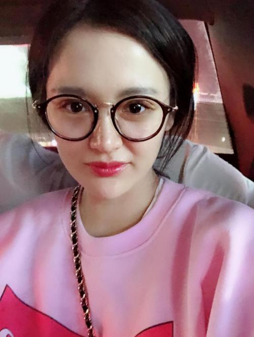 做完双眼皮的真实感受,双眼皮术后20天感觉眼睛变小了