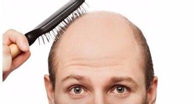 适合治掉头发的茶叶,治掉头发最好的茶