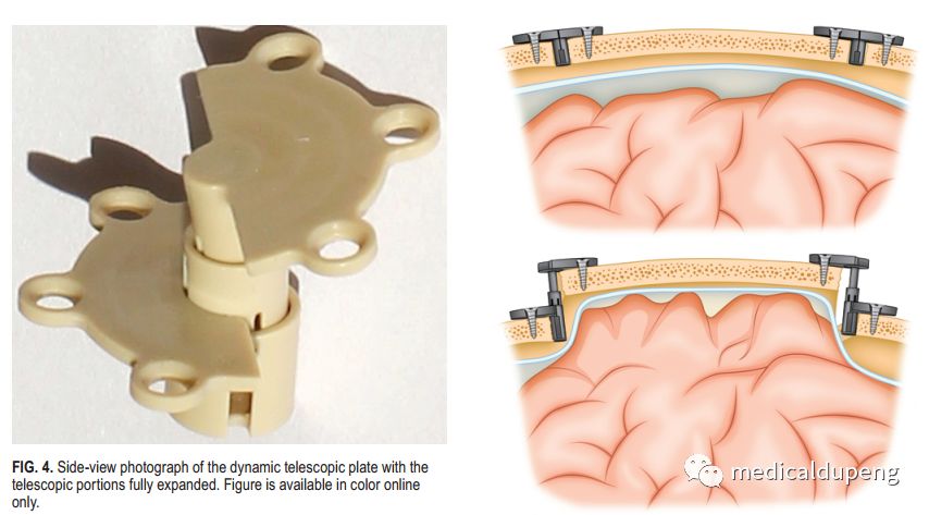 医学插画插图,医学插画sci