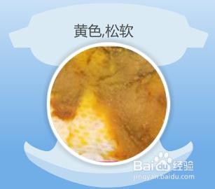 婴儿10-12个月粪便颜色,婴幼儿正常大便的颜色和性状