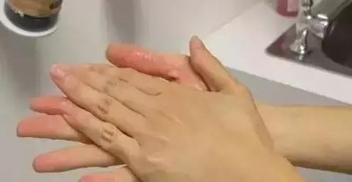 这样拍拍，对98%的眼睛问题好，中老年人都要学学！