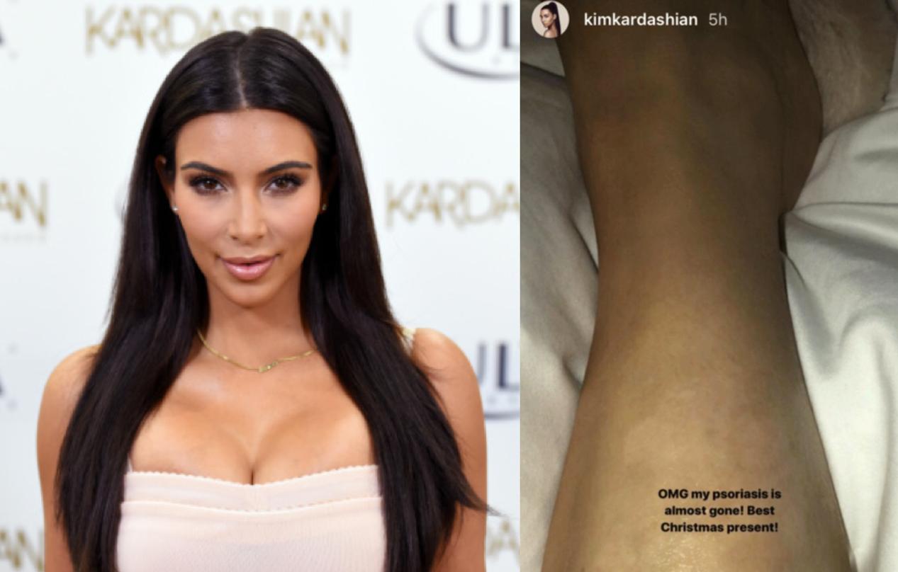 保罗艾伦个人简介,保罗艾伦为什么微软股份那么少