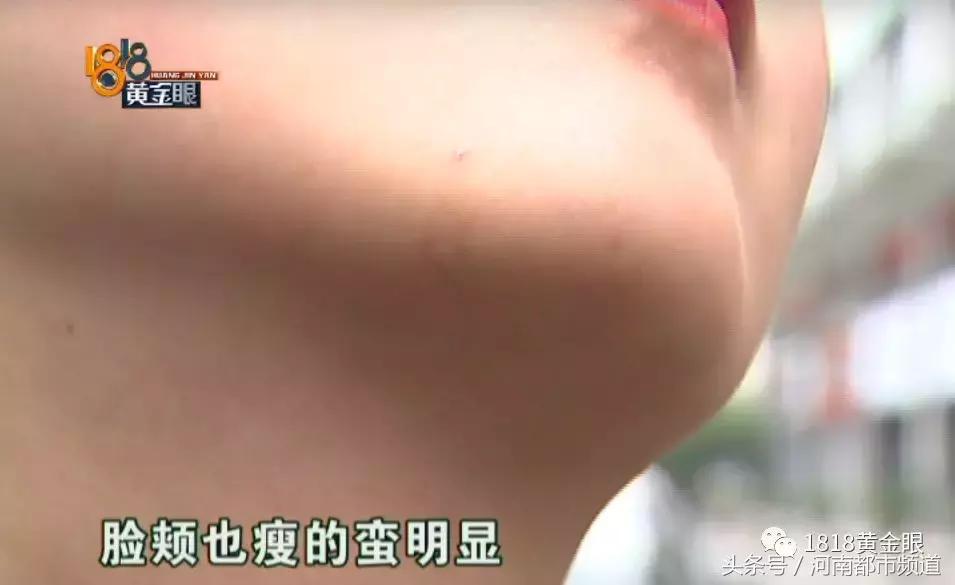 为什么我做溶脂瘦脸都没效果,为什么溶脂瘦脸15天才有效果