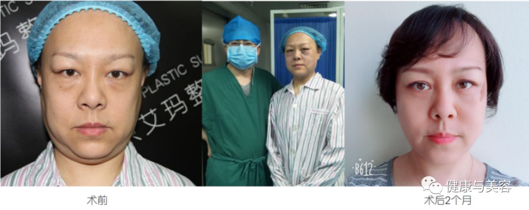 老的优雅《健康与美容》携手整形界权威丁小邦博士专题讲座活动