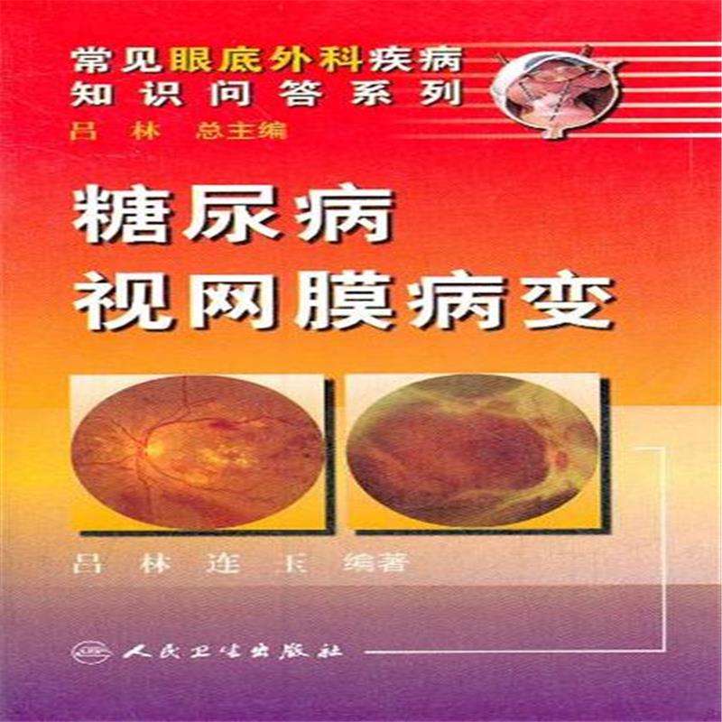 杞菊地黄丸治晚期白内障,杞菊地黄丸治白内障和黄斑病变吗