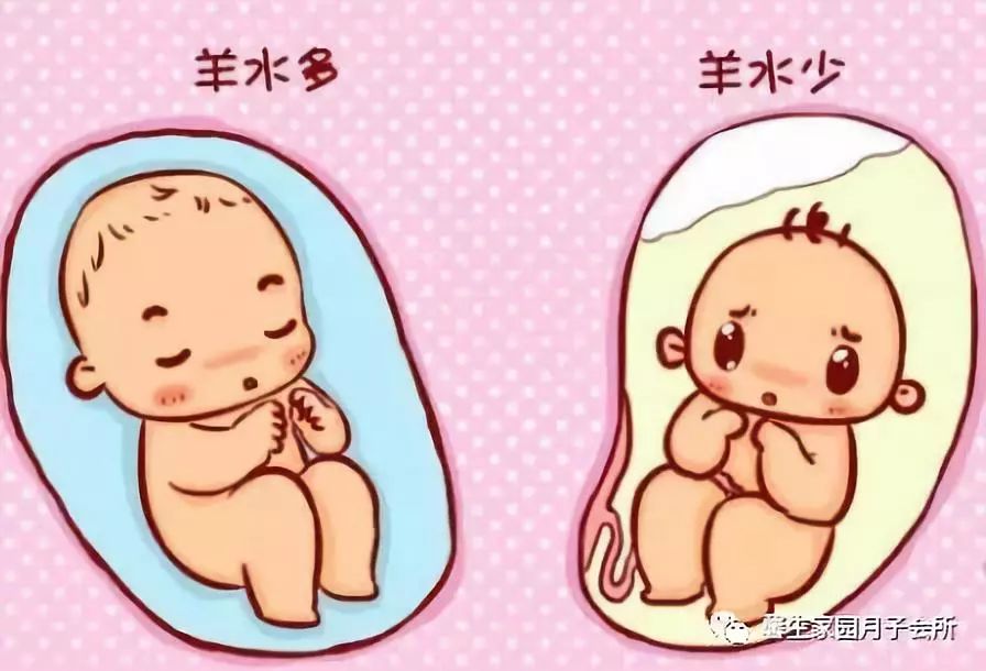 孕妇羊水过少多喝水真的有用吗,一天不喝水羊水就少怎么回事