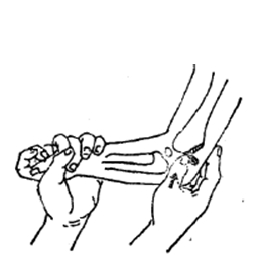 中医骨折治疗原则,中医骨伤整复术