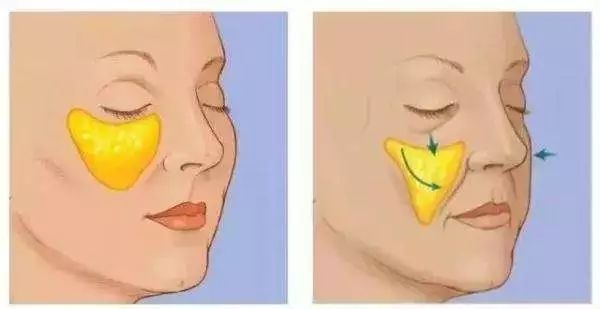 胶原蛋白微商套路,胶原蛋白微商骗局